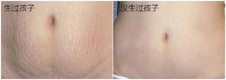 女人生没生过孩子看哪里,女人生没生过孩子去哪里鉴定