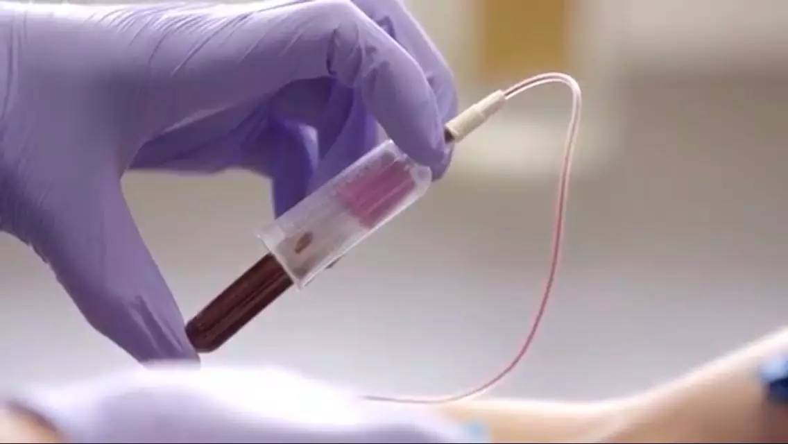 新款智能手机APP:用自拍筛查胰腺癌!