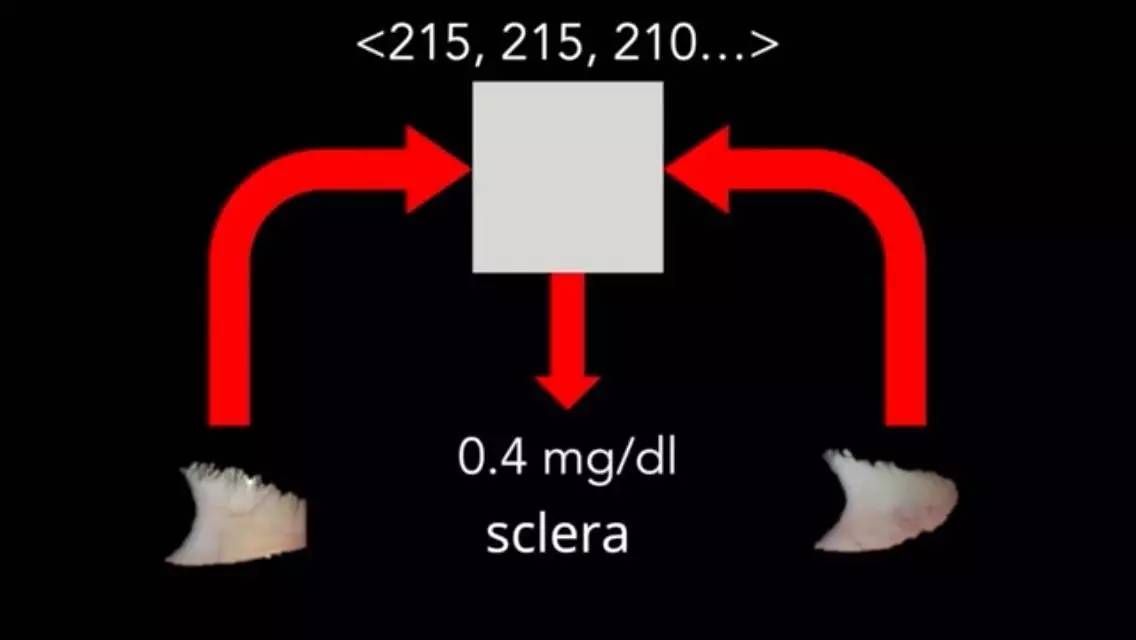 新款智能手机APP:用自拍筛查胰腺癌!
