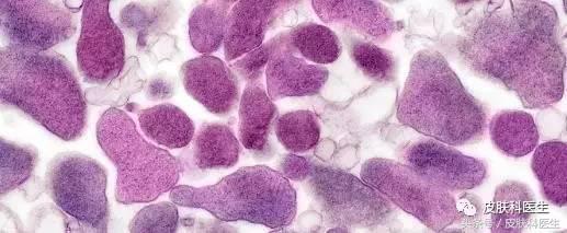 生殖道支原体感染诊治专家共识