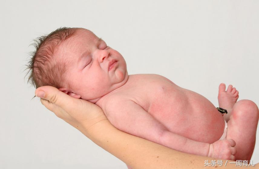 宝宝泪囊炎怎么引起的,得了泪囊炎用什么药