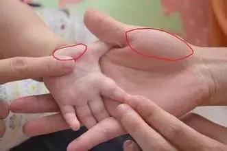 上火心火吃什么药,上火心火