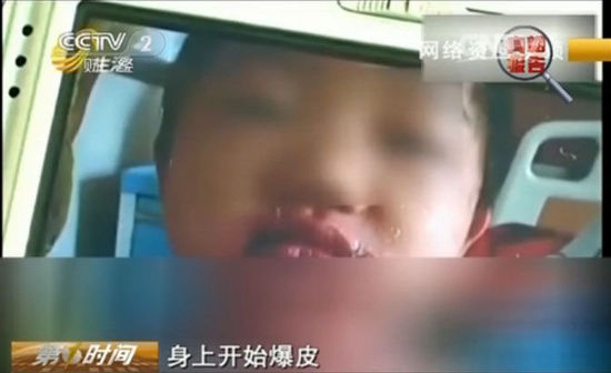 皮小6：有人因它患上败血症！这种路边的“哄娃神器”别再买了！