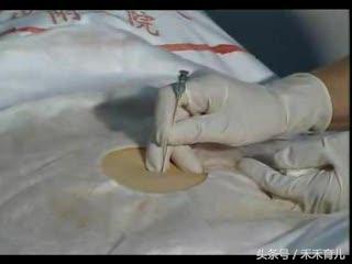 一个唐筛3000元,纠结还要不要做,怎么那么贵?