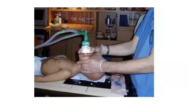 演讲PPT/法国居里研究所皮埃尔贝：儿童神经肿瘤的质子放疗