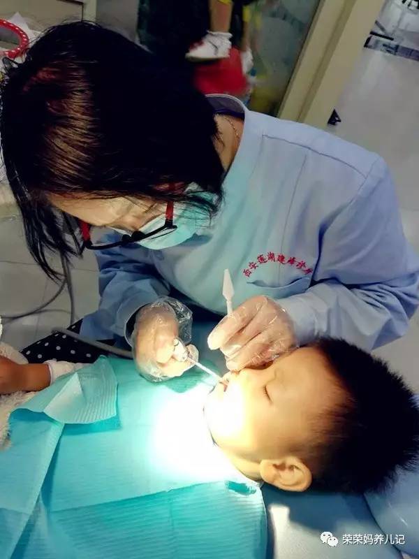 儿童涂氟前需要做口腔内窥镜吗,小孩牙齿涂氟好还是做窝沟封闭好