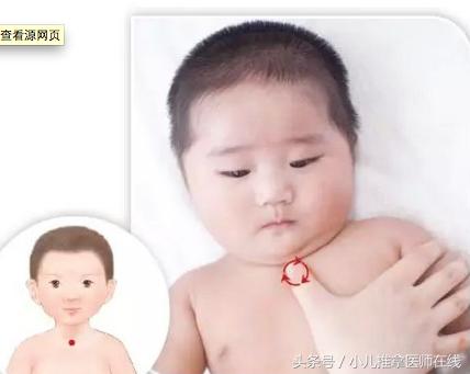 支气管肺炎能推拿好吗,小儿支气管肺炎推拿视频