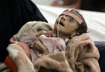 一岁半宝宝营养不良如何食补,营养不良的宝宝