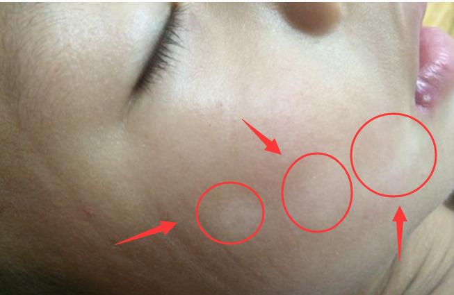 婴儿的脸俏皮怎么回事,宝宝有点大小脸正常吗