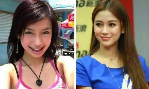 牙整形需要什么过程,整形整牙全过程