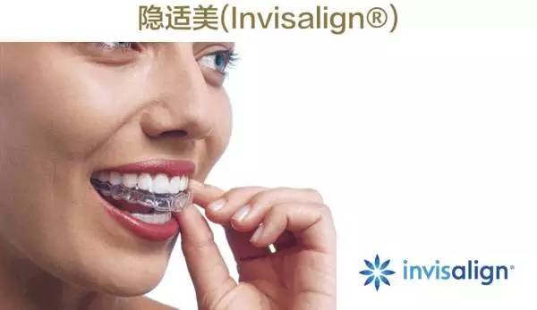 牙整形需要什么过程,整形整牙全过程