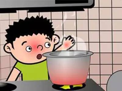 孩子烫伤的紧急处理四大步骤,孩子烫伤后最佳治疗时间只有120秒