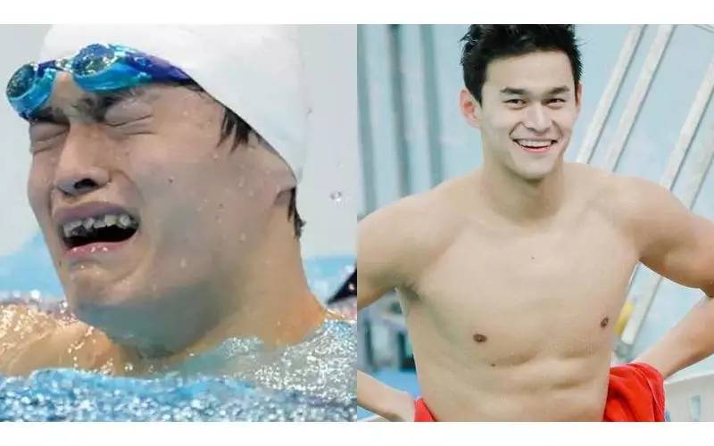 牙整形需要什么过程,整形整牙全过程