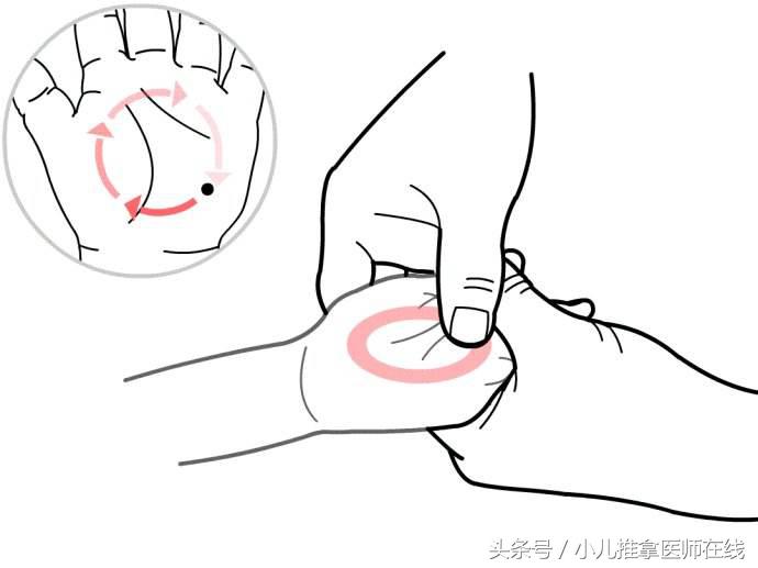 新生儿肺炎怎么判断严重程度,新生儿咳嗽怎么判断是不是肺炎