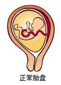 边缘性前置胎盘见红影响胎儿吗,孕晚期前置胎盘为什么出血