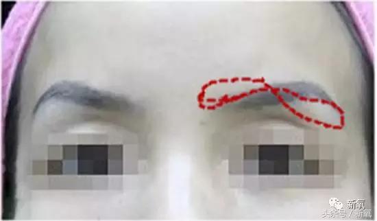 杨紫瘦了腿显得不纤细,杨紫变美之路脸怎么瘦的