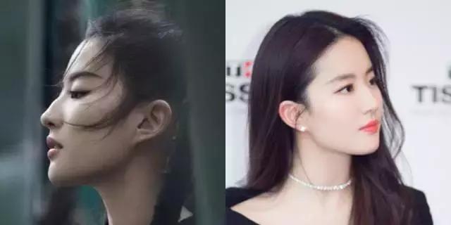 染发漂发之后怎么保护头皮,染发伤了头皮要擦什么药