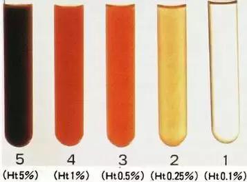 一泡尿就能看出你的肾好不好,第一泡尿如何看健康