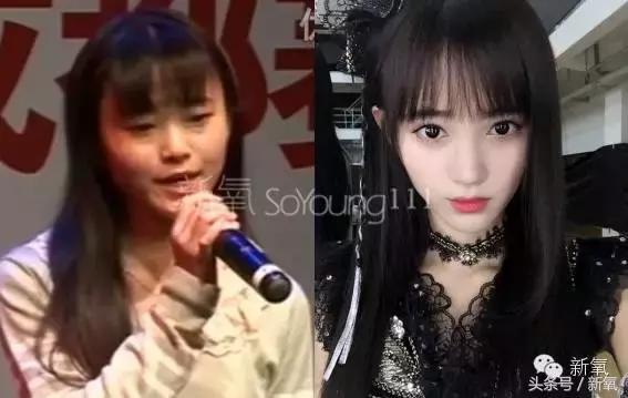 杨紫瘦了腿显得不纤细,杨紫变美之路脸怎么瘦的
