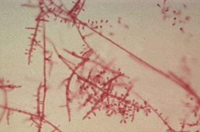 怎么清洗腋毛上的白色分泌物,腋毛上的白色物质难清洗