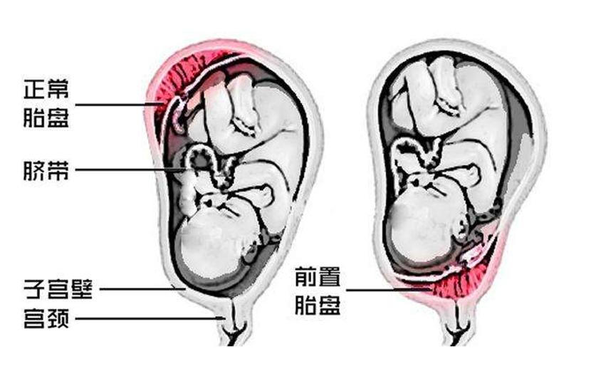生二胎的年龄参考表,2017年生儿子生女图