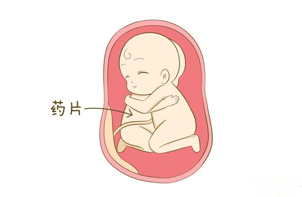 预产期40周到了，宝宝还没发动，继续等待还是催产？