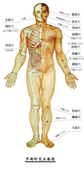 平衡针灸38针处方,平衡针降血压穴位
