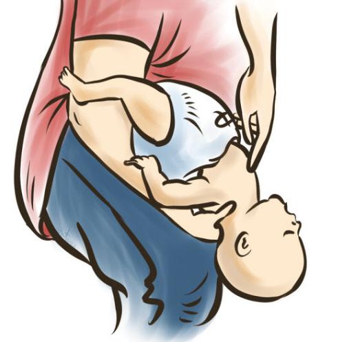 小孩误吞食物卡住喉咙急救,小孩吃东西卡住了海姆立克急救法