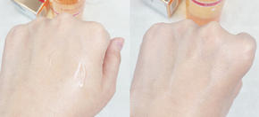 薏仁水娥佩兰收缩毛孔吗,收缩毛孔城野医生有用吗