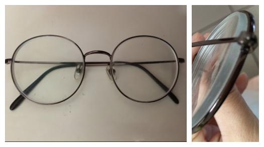 近视眼手术7年后的亲身经历,做近视眼手术的人的亲身经历