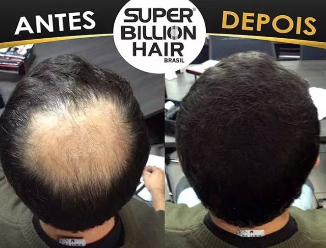 岛国发明遮秃喷雾,只要喷一喷,‘地中海’‘秒变’‘热带雨林’!