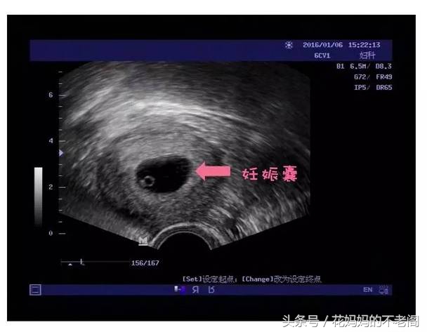 超全孕期产检攻略新手妈妈必备,最全孕期产检的项目及注意事项