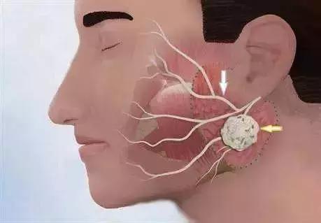 右眼皮一直跳是跳财还是跳灾,左眼皮跳财右眼皮跳灾的征兆