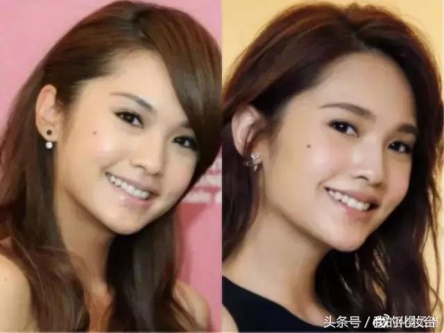 去天生颈纹的方法,颈纹多怎么锻炼