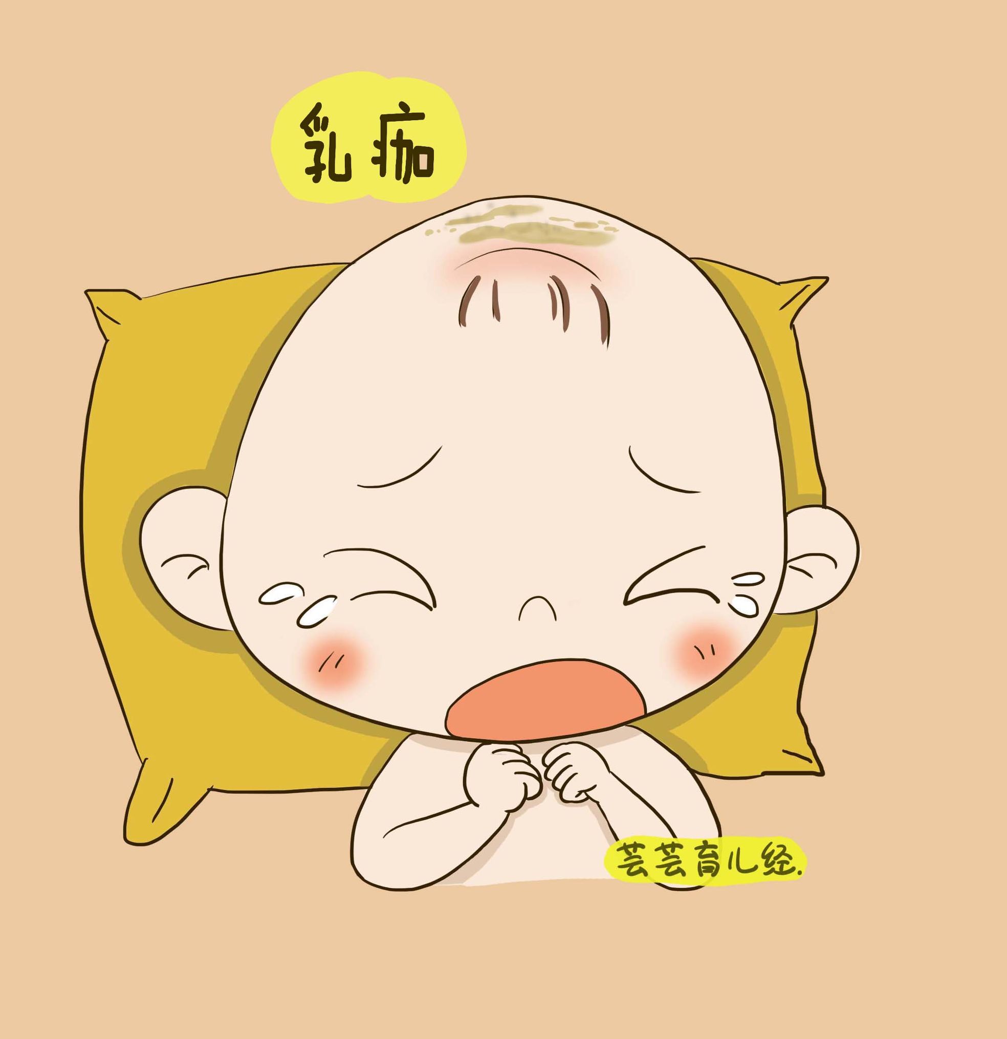 宝宝头上长奶痂如何清洗,孕期乳痂怎么快速清洗