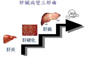 慢性肝炎到肝衰多久,慢性肝病一般病程多长会得肝癌