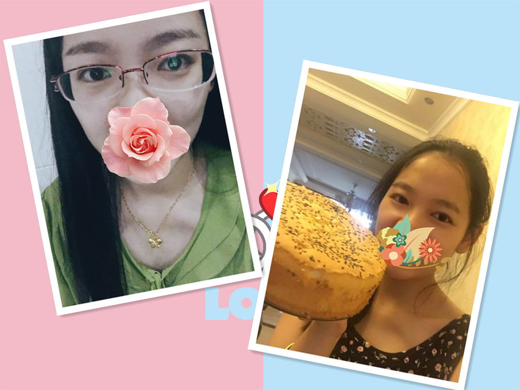 近视眼手术7年后的亲身经历,做近视眼手术的人的亲身经历