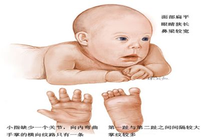 产检都检查什么？这几个重要的检查你做了吗？