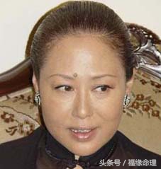 脸上十大好痣,脸上哪些痣是不好的痣图片