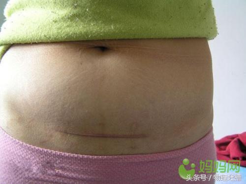 产妇要当心这4点,产妇要注意的3大问题