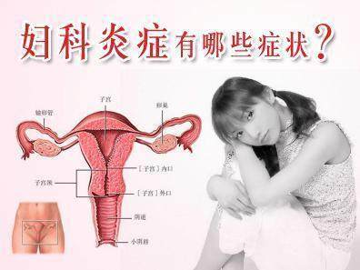 只要你是成年女性，就进来看看如何判断自己有没有妇科病
