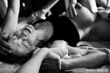 无痛分娩为何普及率不高,现在无痛分娩普遍吗