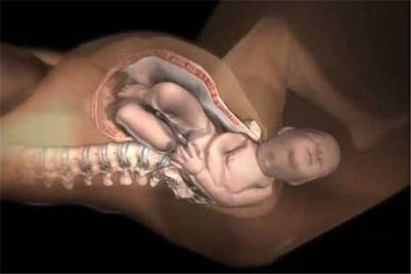 顺产还是剖腹产如何选择,分娩可以选择剖腹产吗