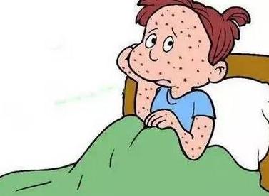 九价疫苗对扁平疣有预防作用吗,脸上长hpv扁平疣怎么预防