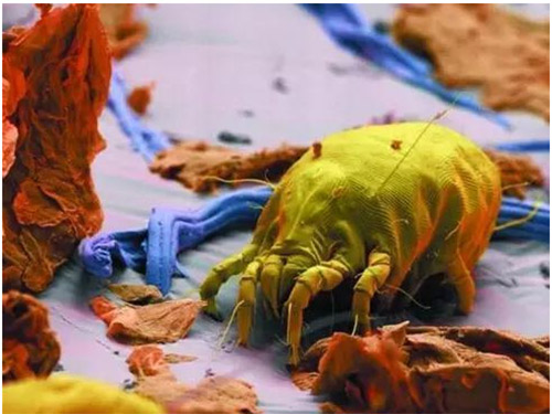 头发里的白色颗粒是脂溢性脱发吗,头痒抠出的黄泥是什么