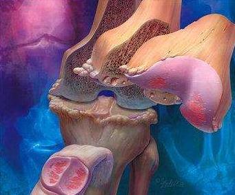 全国最好的治骨关节炎的医院,关节炎医院十大排名