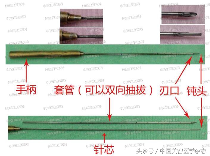 小切口线雕面部提升术视频,线雕面部提升术危害