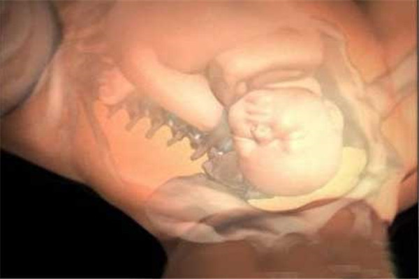 顺产还是剖腹产如何选择,分娩可以选择剖腹产吗