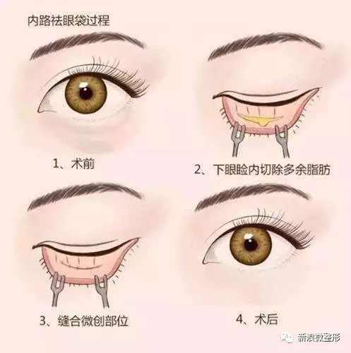 林小宅显老,林小宅算是翻车了吗