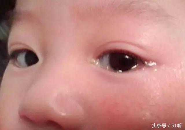 小孩误吞橡皮泥有伤害吗,一岁婴儿误食橡皮泥该如何处理